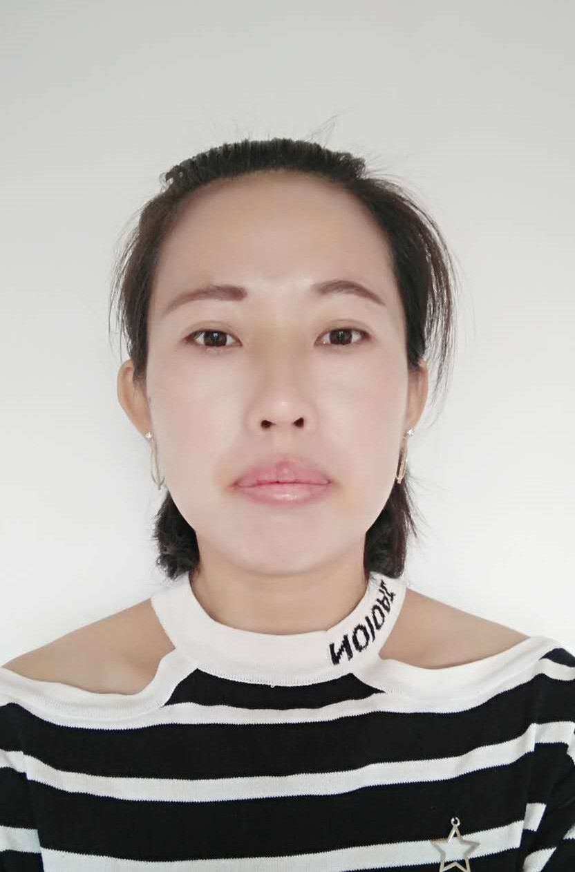 马平（女）养老护理